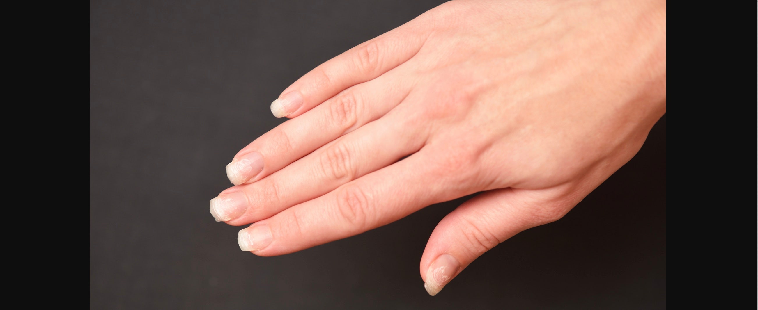 Surprising Things Your Nails Say About Your Health